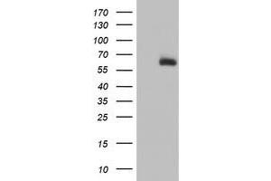 Western Blotting (WB) image for anti-ACSM5 / MACS3 antibody (ABIN1496425) (ACSM5 / MACS3 anticorps)