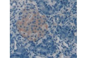 IHC-P analysis of Kidney tissue, with DAB staining. (POMT1 anticorps  (AA 318-513))