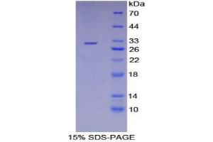 SDS-PAGE analysis of Human LIMS1 Protein. (LIMS1 Protéine)