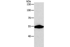 Western Blot analysis of NIH/3T3 cell using CALR Polyclonal Antibody at dilution of 1:800 (Calreticulin anticorps)