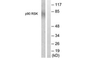 Western blot analysis of extracts from 293 cells, treated with PMA 125ng/ml 30', using p90 RSK (Ab-380) Antibody. (RPS6KA3 anticorps  (AA 346-395))