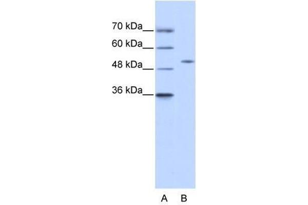 ZNF555 anticorps  (N-Term)