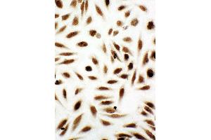 Immunohistochemistry (IHC) image for anti-Nucleoside diphosphate kinase B (NME2) (AA 137-152), (C-Term) antibody (ABIN3044198)