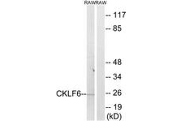 CMTM6 anticorps  (AA 131-180)