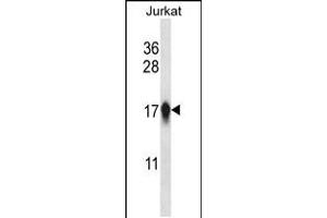 Western blot analysis in Jurkat cell line lysates (35ug/lane). (CENPA anticorps  (AA 82-110))