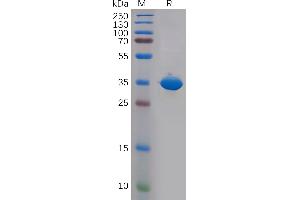 Human CD81 Protein, hFc Tag on SDS-PAGE under reducing condition. (CD81 Protein (CD81) (AA 113-201) (Fc Tag))
