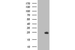 HEK293T cells were transfected with the pCMV6-ENTRY control (Left lane) or pCMV6-ENTRY DTYMK (Right lane) cDNA for 48 hrs and lysed. (DTYMK anticorps)