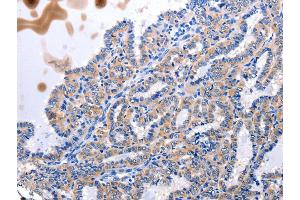 Immunohistochemistry (IHC) image for anti-Urotensin 2 (UTS2) antibody (ABIN2427518) (Urotensin 2 anticorps)