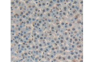 IHC-P analysis of liver tissue, with DAB staining. (DKC1 anticorps  (AA 298-509))