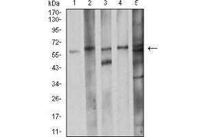 Western Blotting (WB) image for anti-Cell Division Cycle 37 Homolog (S. Cerevisiae) (CDC37) (AA 241-378) antibody (ABIN5918060) (CDC37 anticorps  (AA 241-378))