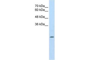 Western Blotting (WB) image for anti-Aldehyde Dehydrogenase 4 Family, Member A1 (ALDH4A1) antibody (ABIN2462883) (ALDH4A1 anticorps)