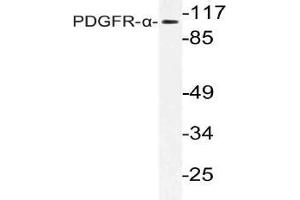 Western blot (WB) analysis of PDGFR-alpha antibody in extracts from Jurkat cells. (PDGFRA anticorps)