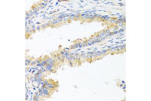 Immunohistochemistry of paraffin-embedded human prostate using ApoE antibody (ABIN5975768) at dilution of 1/100 (40x lens). (APOE anticorps)