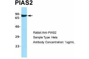 Host:  Rabbit  Target Name:  PIAS2  Sample Type:  Hela  Antibody Dilution:  1. (PIAS2 anticorps  (C-Term))