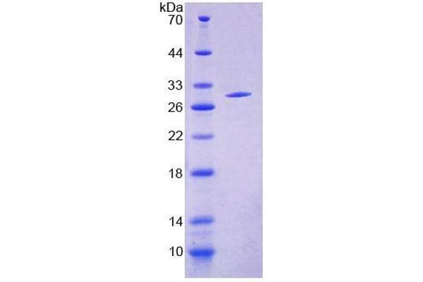 ACSM1 Protein (AA 370-557) (T7 tag,His tag)