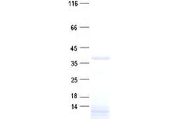 C3orf38 Protein (His tag)