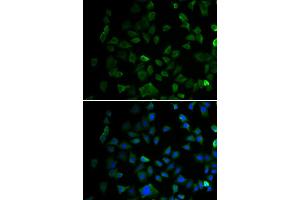 Immunofluorescence analysis of U2OS cell using MAP2K1 antibody. (MEK1 anticorps)