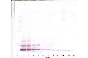 Image no. 1 for anti-Chemokine (C-C Motif) Ligand 26 (CCL26) antibody (ABIN465091) (CCL26 anticorps)