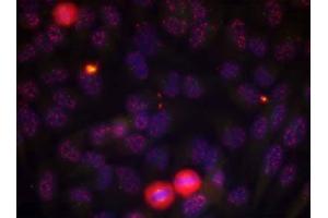 Immunofluorescence staining of methanol-fixed HeLa cells using Elk-1 (phospho-Thr417) antibody (E011038, Red) (ELK1 anticorps  (pThr417))