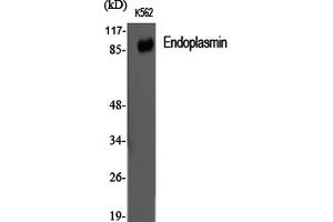 Western Blotting (WB) image for anti-Heat Shock Protein 90kDa beta (Grp94), Member 1 (HSP90B1) antibody (ABIN5959523) (GRP94 anticorps)