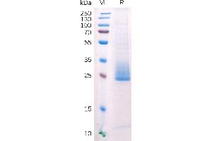 Human ANG Protein, His Tag on SDS-PAGE under reducing condition (ANGPTL3 Protein (AA 17-221) (His tag))