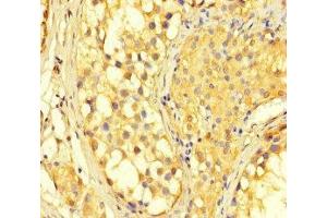Immunohistochemistry of paraffin-embedded human testis tissue using ABIN7150987 at dilution of 1:100 (RNF2 anticorps  (AA 1-100))