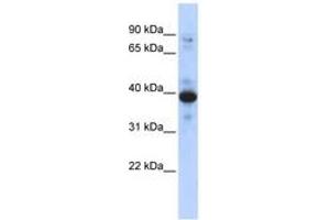 Image no. 1 for anti-Ring Finger Protein 34 (RNF34) (AA 143-192) antibody (ABIN6742950) (RNF34 anticorps  (AA 143-192))