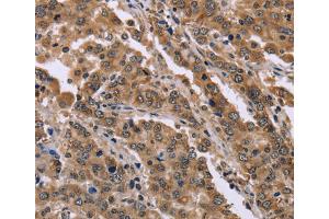 Immunohistochemistry (IHC) image for anti-Family with Sequence Similarity 3, Member B (FAM3B) antibody (ABIN2423425) (FAM3B anticorps)