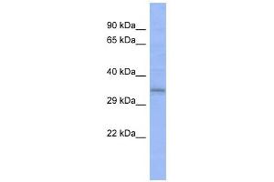 C20ORF111 antibody used at 1 ug/ml to detect target protein. (C20orf111 anticorps  (N-Term))