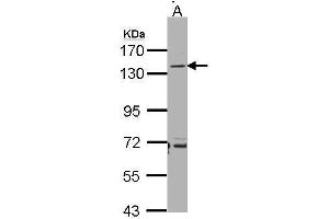 WB Image Sample(30 ug whole cell lysate) A:Raji , 7. (CD22 anticorps)