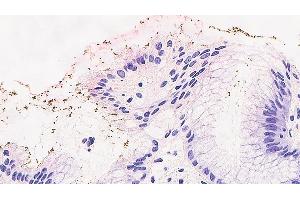 Immunohistochemical staining for Helicobacter pylori: clone ULC3R (Helicobacter Pylori anticorps)