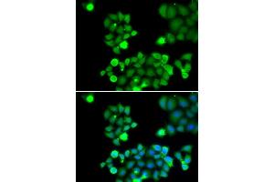 Immunofluorescence analysis of HeLa cell using NEIL1 antibody. (NEIL1 anticorps)