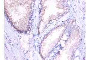 Immunohistochemistry of paraffin-embedded human spleen using MMP1 antibody at dilution of 1:100. (MMP1 anticorps)
