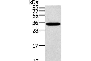 Western Blot analysis of Mouse brain tissue using KCNMB3 Polyclonal Antibody at dilution of 1:300 (KCNMB3 anticorps)