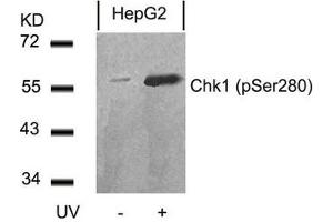 Western blot analysis of extracts from HepG2 cells untreated or treated with UV using Chk1(Phospho-Ser280) Antibody. (CHEK1 anticorps  (pSer280))