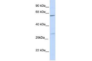 PRPS2 antibody used at 1 ug/ml to detect target protein. (PRPS2 anticorps  (N-Term))