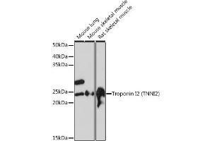 Western blot analysis of extracts of various cell lines, using Troponin I2 (Troponin I2 (TNNI2)) Rabbit mAb (ABIN1679777, ABIN7101727, ABIN7101728 and ABIN7101729) at 1:1000 dilution. (TNNI2 anticorps)