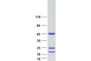 Validation with Western Blot (ASRGL1 Protein (Transcript Variant 2) (Myc-DYKDDDDK Tag))