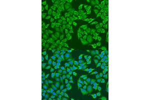 Immunofluorescence analysis of U2OS cells using IGF2BP3 antibody (ABIN6293021) at dilution of 1:100. (IGF2BP3 anticorps)