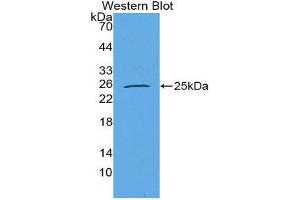 Western Blotting (WB) image for anti-Prolactin-Induced Protein (PIP) (AA 1-146) antibody (ABIN1869810) (PIP anticorps  (AA 1-146))