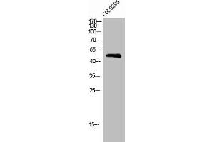 Western Blot analysis of COLO205 cells using Phospho-BLNK (Y96) Polyclonal Antibody (B-Cell Linker anticorps  (pTyr96))
