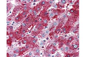 Anti-PACE4 antibody IHC of human liver. (PCSK6 anticorps  (Internal Region))