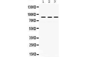 Western Blotting (WB) image for anti-MutL Homolog 1 (MLH1) (AA 722-756), (C-Term) antibody (ABIN3043404) (MLH1 anticorps  (C-Term))