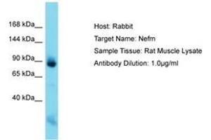 Image no. 1 for anti-Neurofilament Triplet M Protein (NEFM) (C-Term) antibody (ABIN6750526) (NEFM anticorps  (C-Term))