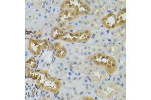 Immunohistochemistry of paraffin-embedded rat kidney using NAT8 antibody. (NAT8 anticorps)