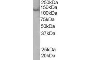 Western Blotting (WB) image for anti-Zinc Finger, FYVE Domain Containing 20 (ZFYVE20) (C-Term) antibody (ABIN2466174) (Rabenosyn 5 anticorps  (C-Term))