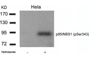 Western blot analysis of extracts from Hela cells untreated or treated with Hydroxyurea using p95/NBS1(Phospho-Ser343) Antibody. (Nibrin anticorps  (pSer343))