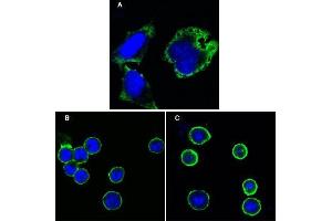 Confocal immunofluorescence analysis of Hela cells (A), BCBL-1 cells (B) and L1210 cells (C) using MPS1 antibody (green). (Mps1 anticorps)