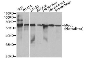 Western blot analysis of extracts of various cell lines, using MGLL antibody. (MGLL anticorps)