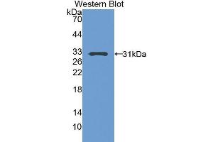 Western Blotting (WB) image for anti-Pregnancy-Associated Plasma Protein A, Pappalysin 1 (PAPPA) (AA 244-501) antibody (ABIN1860125) (PAPPA anticorps  (AA 244-501))